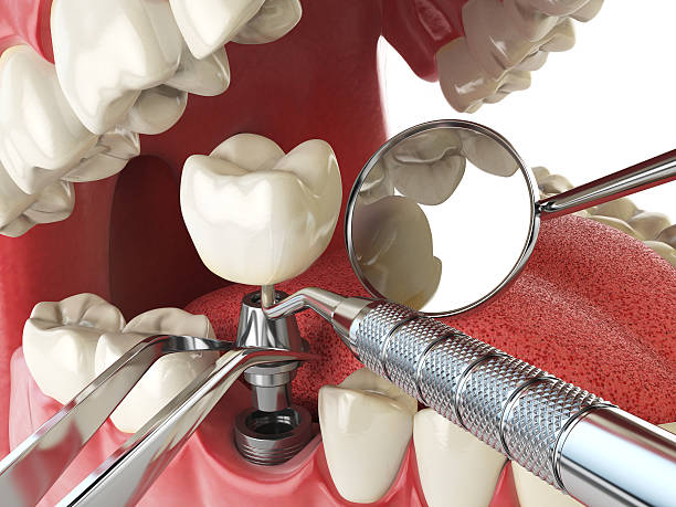 Best Emergency Cosmetic Dentistry in Rochester Hills, MI